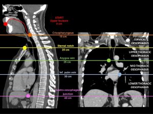 Physiology of swallowing 1 testimage2