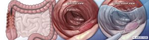 Gastrointest Endosc. 2019 Jun8961109 1116