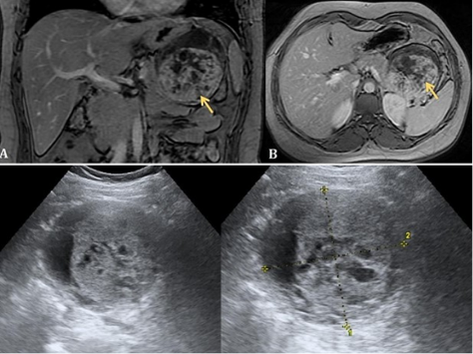 Your paragraph text 13